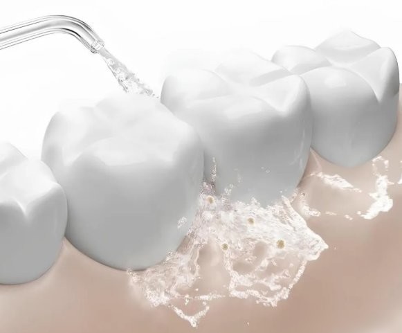 Ирригатор Xiaomi Water Flosser 2 MEO705 (белый, международная версия)